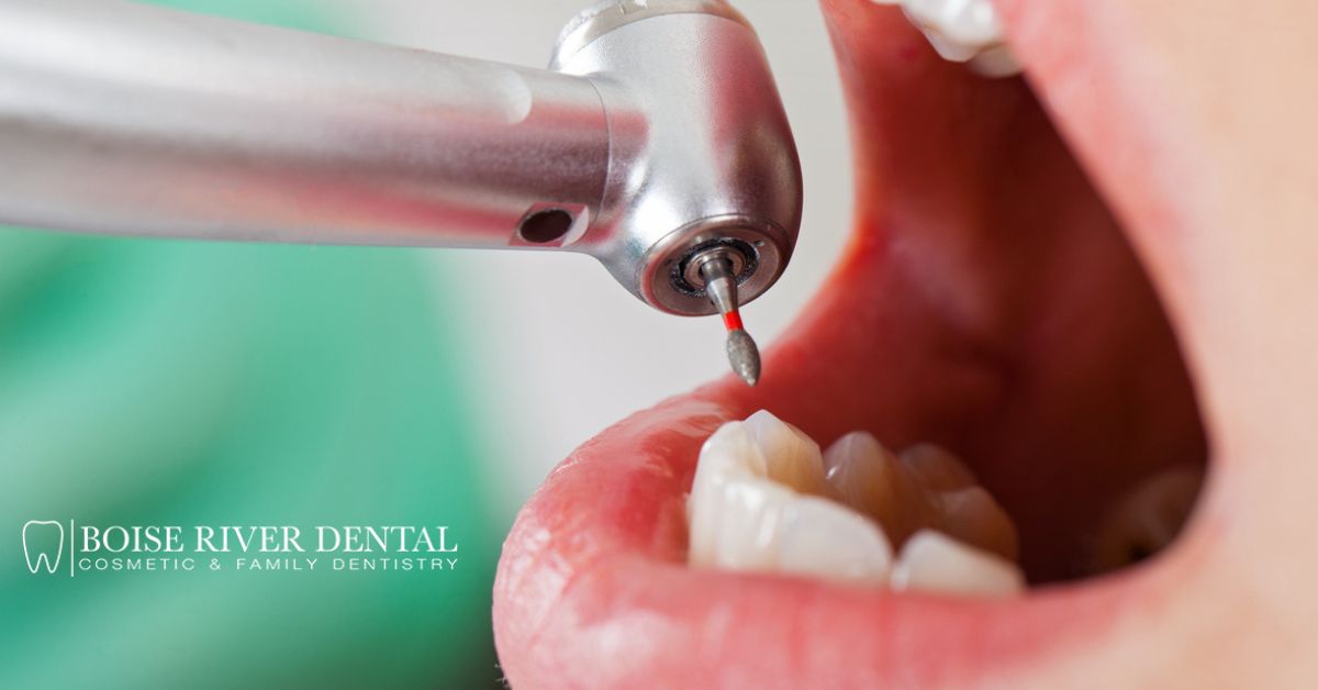 Woman getting her tooth fixed after a dental emergency